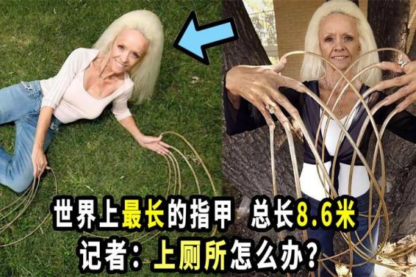 拥有或没有指甲，人的命运竟然如此不同！